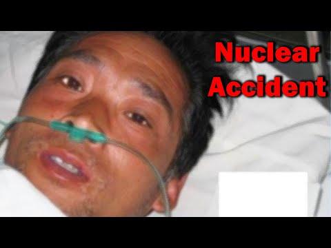 The Most Radioactive Man in History - Hisashi Ouchi thumbnail