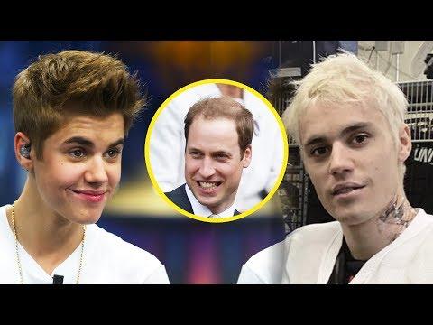 Justin Bieber Slams Prince William For Balding, Then Loses His Hair 8 Years Later thumbnail