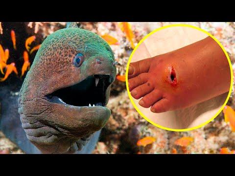 The Most POISONOUS And VENOMOUS FISHES In The World thumbnail