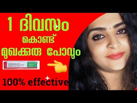 🔥 ഒരു ദിവസം കൊണ്ട് മുഖത്തെ Pimples മാറ്റണോ_How to remove pimples Naturally at home|pimple remove thumbnail