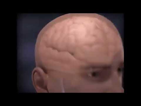 brain aneurysm but is with AH... #yamete #memes #fypシ #popular #goviral thumbnail