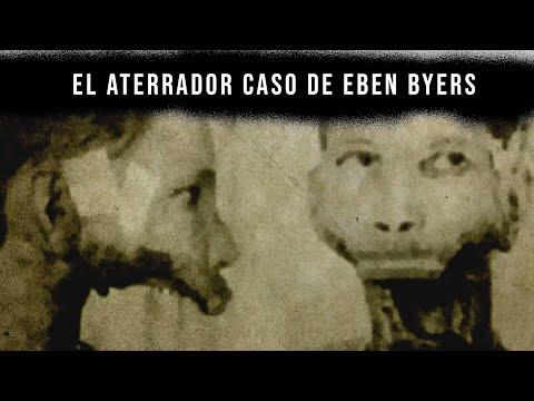 El aterrador caso de Eben Byers - El hombre sin mandíbula thumbnail