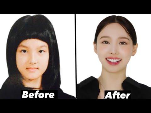 Twice Nayeon EXTREME plastic surgery thumbnail