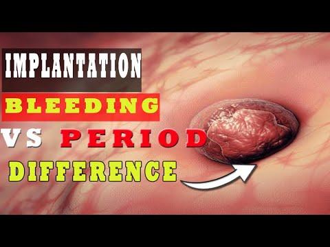 Implantation Bleeding Vs Period – (How to Know the Difference?) 🩸🩸 thumbnail