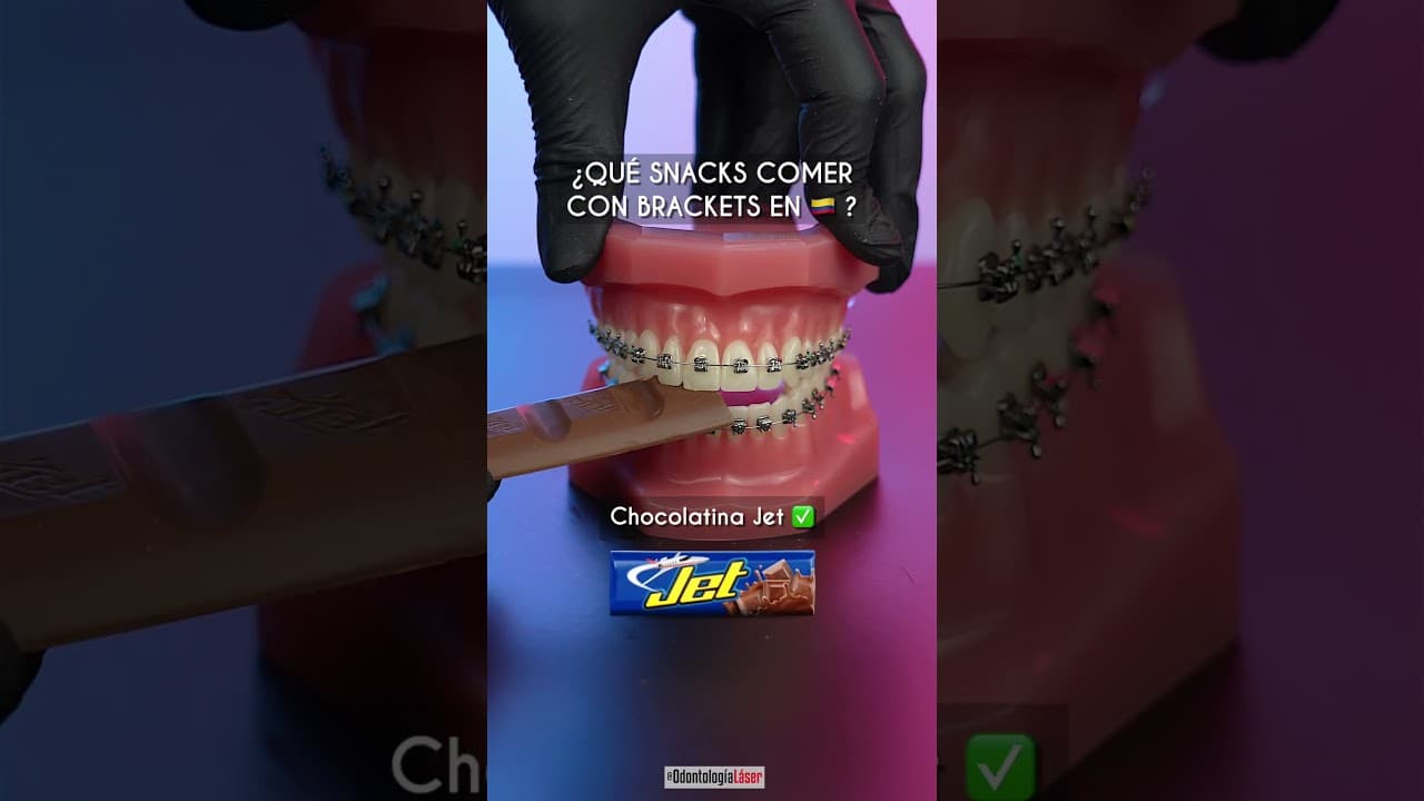 ยฟQue comer con brackets en ๐จ๐ด ? - Odontologรญa Lรกser #Shorts