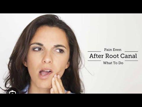 Why Do I Still Have Tooth Pain After My Root Canal thumbnail