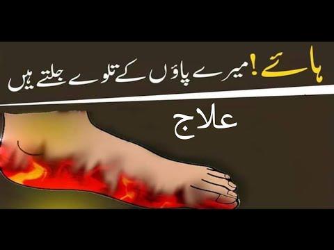 paon jalne ka ilaj in urdu I hath paon jalne ka ilaj I hath paon so jana ki waja thumbnail